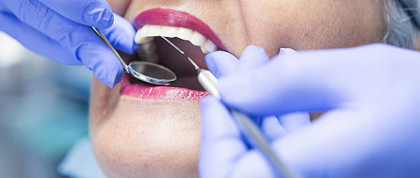 Best Emergency Treatment for Oral Infections in Livonia, MI